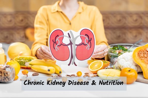 kidney-disease-prevention-diet kidney graphic with foods around to represent best diet for kidney health